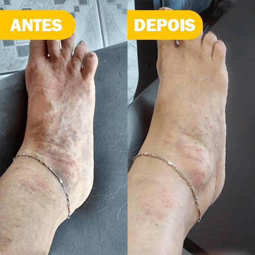 Terceiro Slide