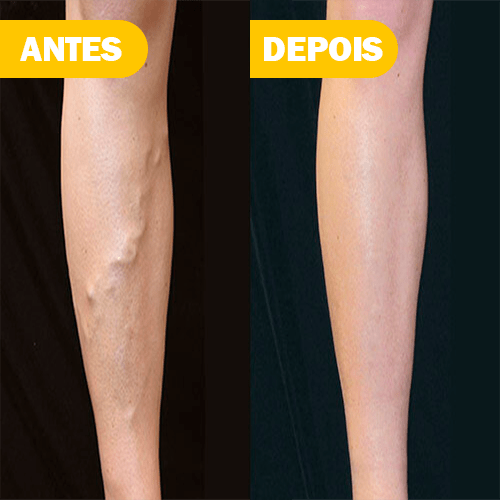 Terceiro Slide