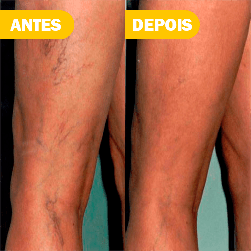Terceiro Slide
